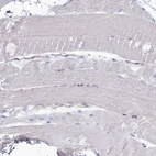 Immunohistochemical staining of human skeletal muscle shows no granular cytoplasmic positivity in myocytes as expected.