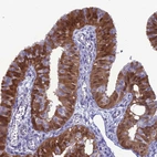 Immunohistochemical staining of human fallopian tube shows moderate cytoplasmic positivity in glandular cells.