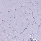 Immunohistochemical staining of human skeletal muscle shows no positivity in myocytes as expected.