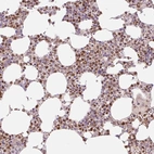 Immunohistochemical staining of human bone marrow shows moderate nuclear positivity in hematopoietic cells.