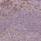 Immunohistochemical staining of human lymph node shows moderate nuclear positivity in non-germinal and germinal center cells.