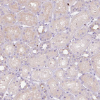 Immunohistochemical staining of human kidney shows very weak positivity in cells in tubules.