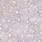Immunohistochemical staining of human kidney shows very weak positivity in cells in tubules.
