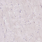 Immunohistochemical staining of human skeletal muscle shows very weak positivity in myocytes.