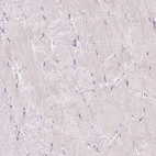 Immunohistochemical staining of human skeletal muscle shows very weak positivity in myocytes.