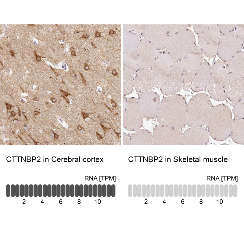Anti-CTTNBP2 Antibody