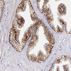 Anti-CD47 Antibody