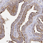 Immunohistochemical staining of human fallopian tube shows moderate to strong membranous positivity in glandular cells.