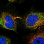 Immunofluorescent staining of human cell line HeLa shows localization to cytosol & midbody ring.