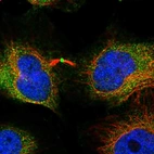 Immunofluorescent staining of human cell line HeLa shows localization to cytosol & midbody ring.