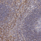 Immunohistochemical staining of human tonsil shows moderate membranous positivity in non - germinal center cells.