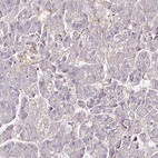 Immunohistochemical staining of human pancreas shows no positivity in exocrine glandular cells as expected.
