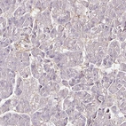 Immunohistochemical staining of human pancreas shows no positivity in exocrine glandular cells as expected.