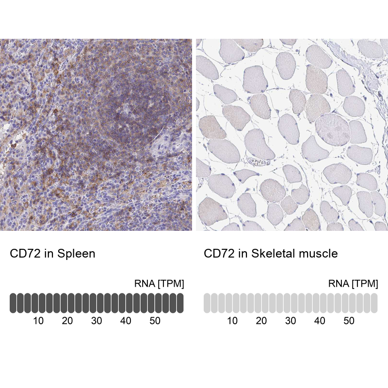 Anti-CD72 Antibody