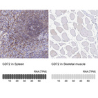 Anti-CD72 Antibody