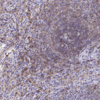 Immunohistochemical staining of human Spleen shows moderate membranous and cytoplasmic positivity in cells in white and red pulp.