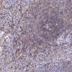 Immunohistochemical staining of human Spleen shows moderate membranous and cytoplasmic positivity in cells in white and red pulp.