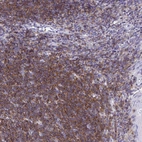 Immunohistochemical staining of human Tonsil shows moderate membranous and cytoplasmic positivity in germinal and non-germinal center cells.
