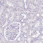 Immunohistochemical staining of human Kidney shows no positivity in cells in tubules as expected.