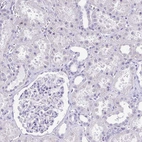 Immunohistochemical staining of human Kidney shows no positivity in cells in tubules as expected.