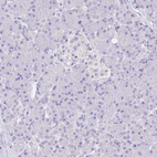 Immunohistochemical staining of human Pancreas shows no positivity in exocrine glandular cells as expected.
