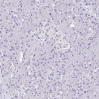 Immunohistochemical staining of human Pancreas shows no positivity in exocrine glandular cells as expected.