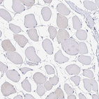 Immunohistochemical staining of human Skeletal muscle shows no positivity in myocytes as expected.