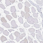 Immunohistochemical staining of human Skeletal muscle shows no positivity in myocytes as expected.