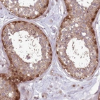 Immunohistochemical staining of human Testis shows strong nuclear and cytoplasmic positivity in spermatogonia.