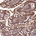 Immunohistochemical staining of human Small intestine shows moderate cytoplasmic positivity in glandular cells.