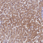 Anti-AHCY Antibody