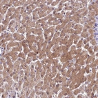 Immunohistochemical staining of human Liver shows moderate cytoplasmic positivity in hepatocytes.