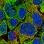 Immunofluorescent staining of human cell line CACO-2 shows localization to cytosol.
