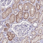 Anti-ESRRG Antibody