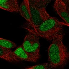 Immunofluorescent staining of human cell line SH-SY5Y shows localization to nucleus.