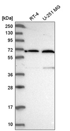 Anti-UTP15 Antibody