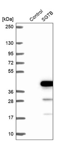 Anti-SGTB Antibody