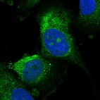 Immunofluorescent staining of human cell line U-251 MG shows localization to nucleoli & endoplasmic reticulum.