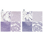 Immunohistochemical staining of human breast, cerebral cortex, lymphoid tissues and placenta using Anti-PLIN4 antibody HPA044682 (A) shows similar protein distribution across tissues to independent antibody HPA054657 (B).