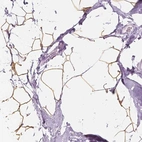 Immunohistochemical staining of human breast shows strong cytoplasmic positivity in adipocytes.
