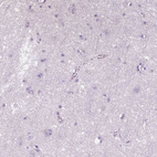 Immunohistochemical staining of human cerebral cortex shows no positivity in neurons as expected.