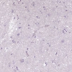 Immunohistochemical staining of human cerebral cortex shows no positivity in neurons as expected.
