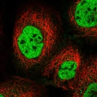 Immunofluorescent staining of human cell line A-431 shows localization to nucleoplasm.