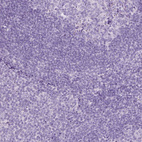 Immunohistochemical staining of human tonsil shows no positivity in non-germinal center cells as expected.