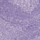 Immunohistochemical staining of human tonsil shows no positivity in non-germinal center cells as expected.