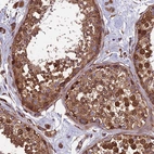 Immunohistochemical staining of human testis shows strong cytoplasmic and nuclear positivity in cells in seminiferous ducts.