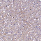 Immunohistochemical staining of human liver shows very weak cytoplasmic positivity in hepatocytes.