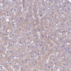 Immunohistochemical staining of human liver shows very weak cytoplasmic positivity in hepatocytes.