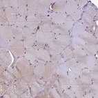 Immunohistochemical staining of human skeletal muscle shows very weak cytoplasmic positivity in myocytes.