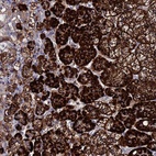 Anti-TCP10L Antibody